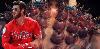 What is “cupping therapy” and does it actually work? cupping therapy