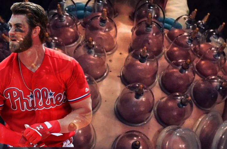 What is “cupping therapy” and does it actually work? cupping therapy